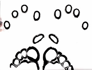 kirlian